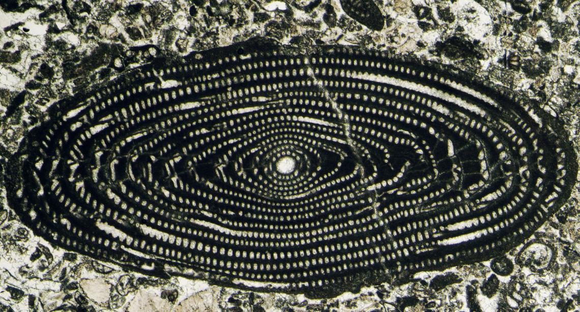 Shot from a microscope.